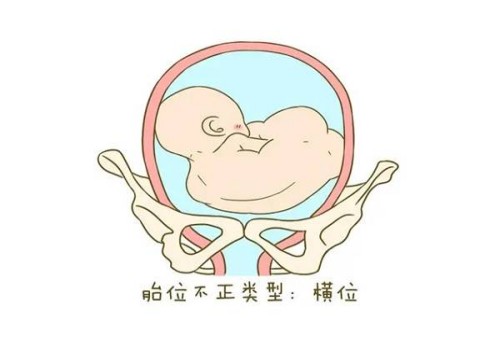 天津代怀生男孩机构：﻿剖宫产后收腹带需要戴多久？附佩戴时间及注意事项